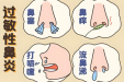 药师说 | 春季鼻炎高发，这五类常用药你用对了吗？