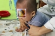 娃的脖子不太对？切勿错过治疗关键期！