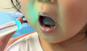 get一种新知识——儿科物理辅助消炎手段